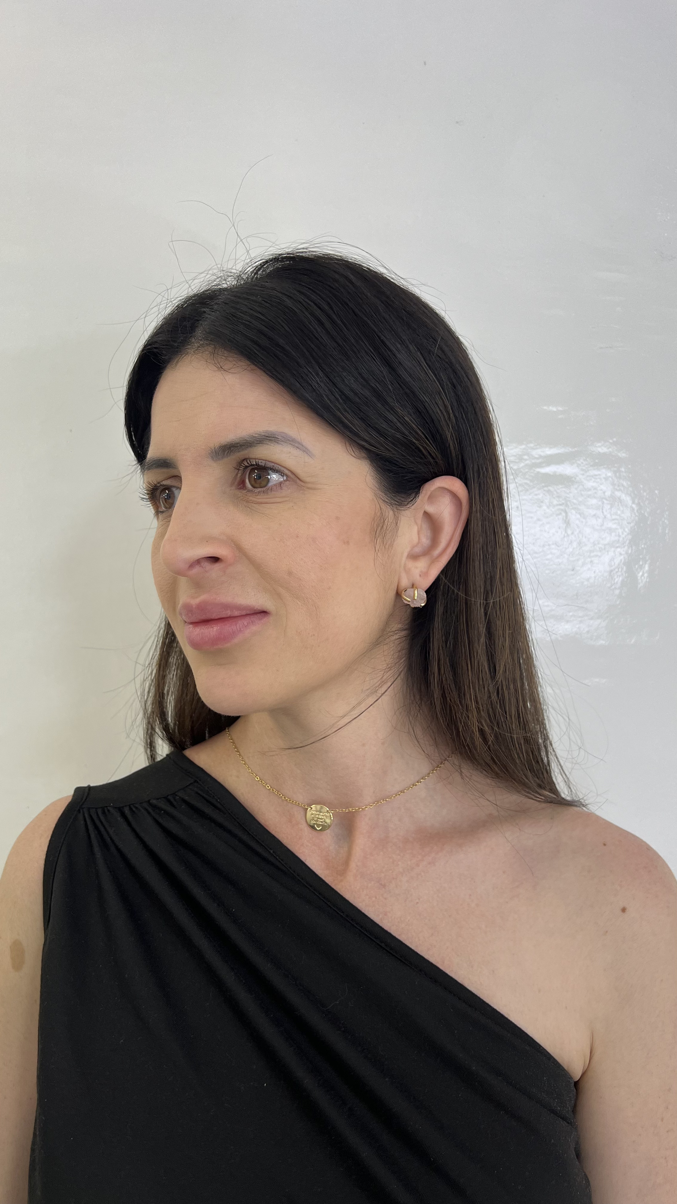 Rita antes do tratamento - lado direito